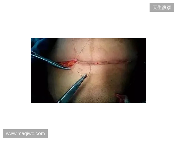 广州豹官方:杨浩眉弓伤口缝合30余针,预计5-7天后拆线 广州豹官方:杨浩眉弓伤口缝合30余针,预计5-7天后拆线